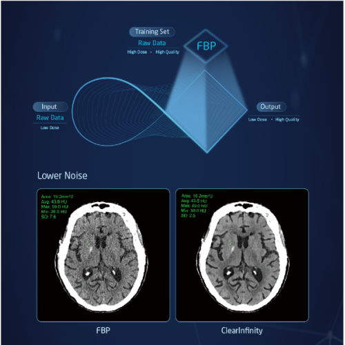 mri machine manufacturer
