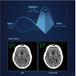 PET CT Scan Machine